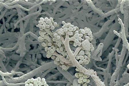 Forrás: Liz Hirst/Wellcome Photo Library