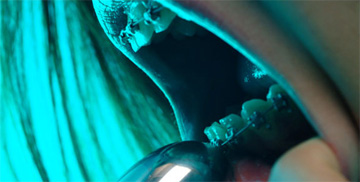 Forr�s: [origo]