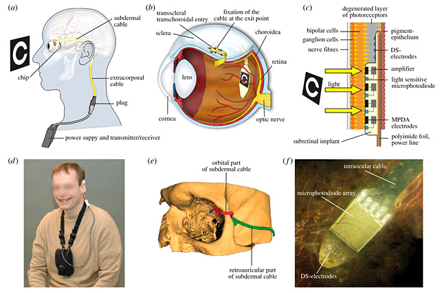 Forrás: Implant AG, Proceedings of the Royal Society B Forrás: Implant AG, Proceedings of the Royal Society B